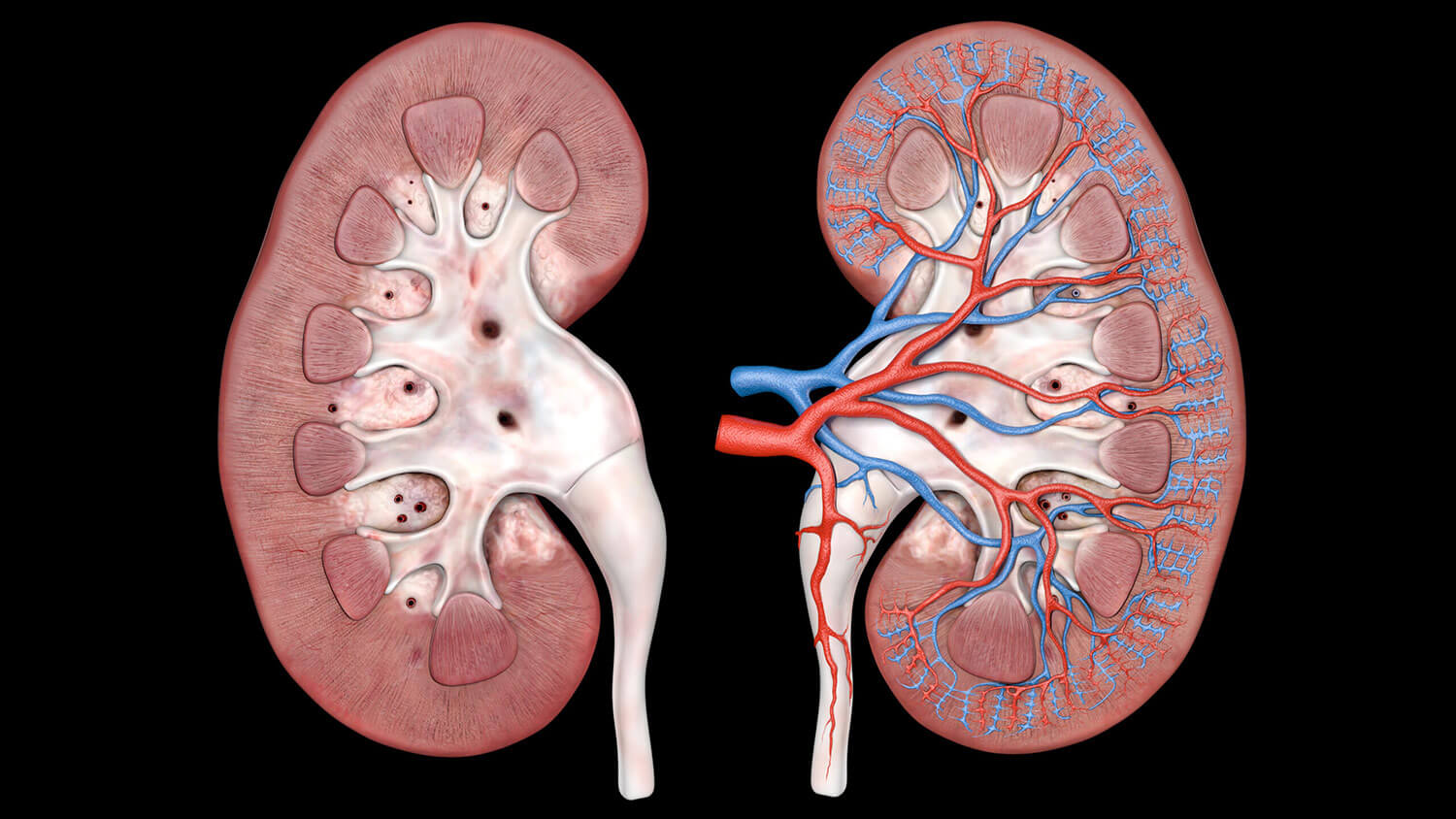 answering-common-questions-about-diabetic-kidney-disease
